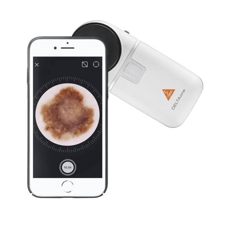 Dermatoscope HEINE DELTAone édition blanche