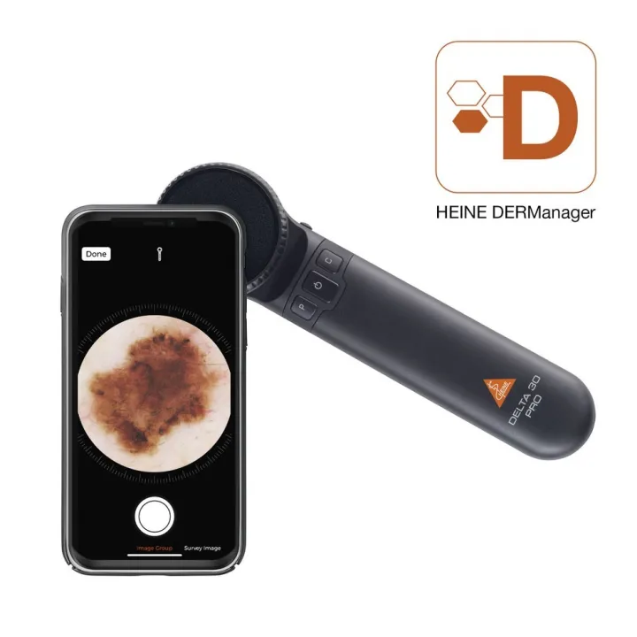Dermatoscope HEINE DELTA 30 Pro