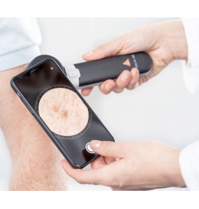 HEINE adaptateur smartphone universel mag pour DELTA 30