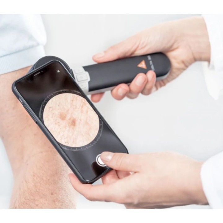 HEINE adaptateur smartphone universel mag pour DELTA 30 et DELTAone