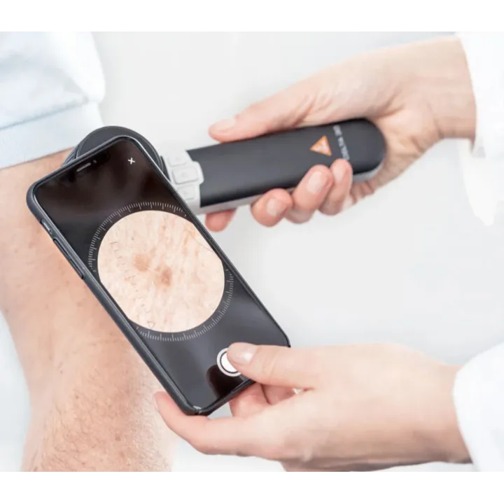 HEINE adaptateur smartphone universel mag pour DELTA 30 et DELTAone