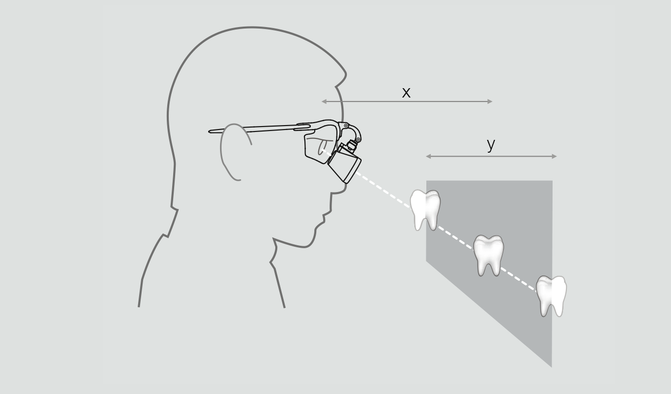 HEINE illustrant la distance de travail (X) entre les yeux et le patient